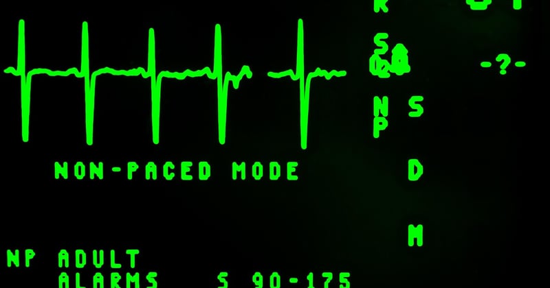 EKG Auswertung leicht gemacht: So lesen Sie jedes EKG richtig